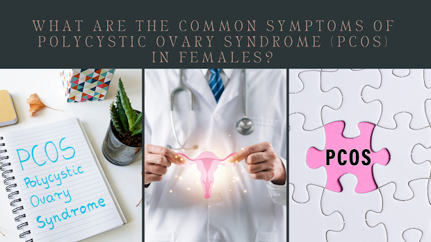Symptoms of PCOS