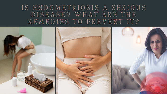 endometriosis