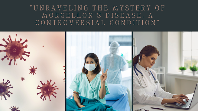 Morgellon’s Disease