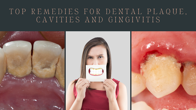 Top Remedies for Dental Plaque, Cavities, Whitening Teeth and Gingivitis (Complete Guide)